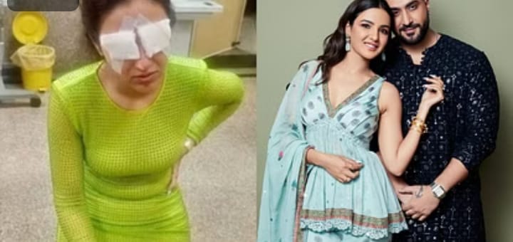 कॉर्निया डैमेज होने के बाद दर्द में थीं जैस्मिन, अली ने हर मिनट पढ़ी दुआ, दिया हेल्थ अपडेट