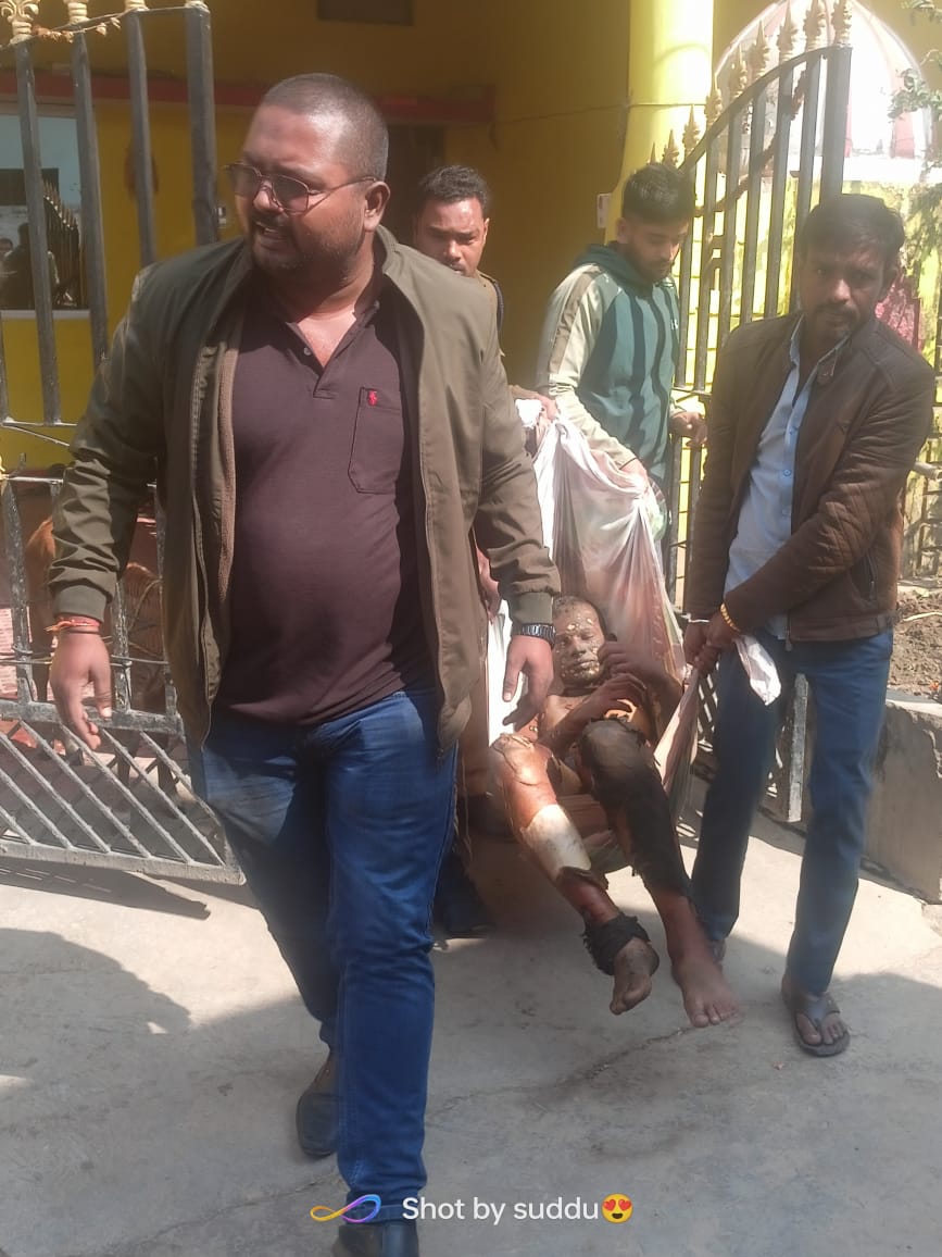 बिलासपुर में सनसनीखेज घटना, लॉ स्टूडेंट ने खुद को लगाई आग